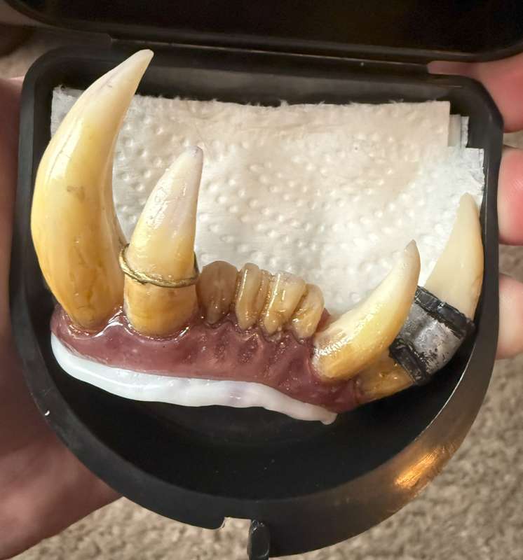 Who's Teeth are These?