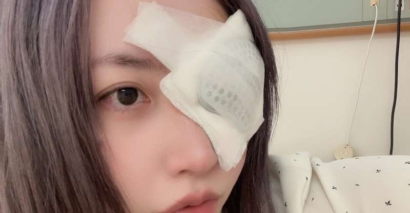 目のはなし